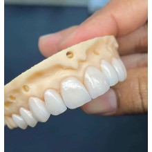 活動(dòng)義齒; 固定義齒; 假牙加工; 烤瓷牙; 二氧化鋯; 貴金屬烤瓷牙