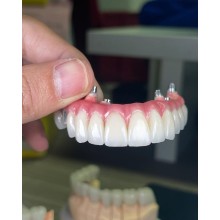 種植牙馬龍橋生產廠家 （Maryland Br