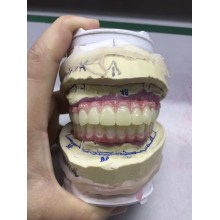 深圳種植牙外貿加工廠 種植牙公司出